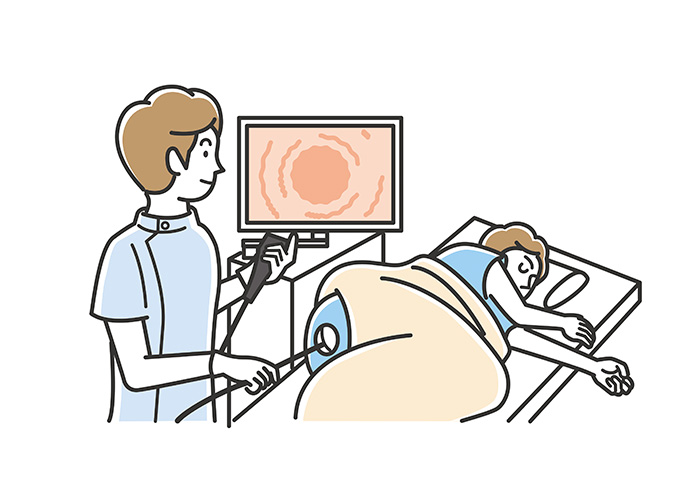 下部消化管内視鏡検査（大腸カメラ/大腸内視鏡検査）