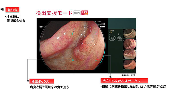 検出支援モード