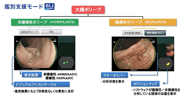 鑑別支援モード